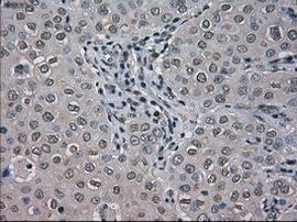 BUB1B Antibody in Immunohistochemistry (Paraffin) (IHC (P))