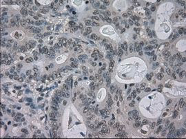 BUB1B Antibody in Immunohistochemistry (Paraffin) (IHC (P))