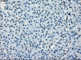 BUB1B Antibody in Immunohistochemistry (Paraffin) (IHC (P))