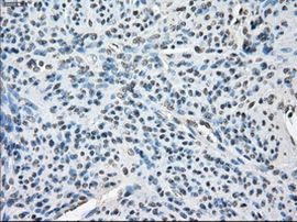 BUB1B Antibody in Immunohistochemistry (Paraffin) (IHC (P))