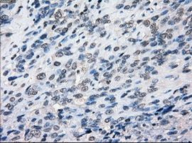 BUB1B Antibody in Immunohistochemistry (Paraffin) (IHC (P))