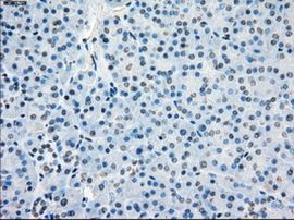 BUB1B Antibody in Immunohistochemistry (Paraffin) (IHC (P))