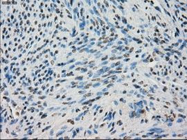 BUB1B Antibody in Immunohistochemistry (Paraffin) (IHC (P))