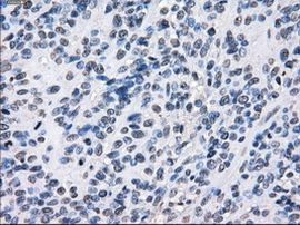 BUB1B Antibody in Immunohistochemistry (Paraffin) (IHC (P))