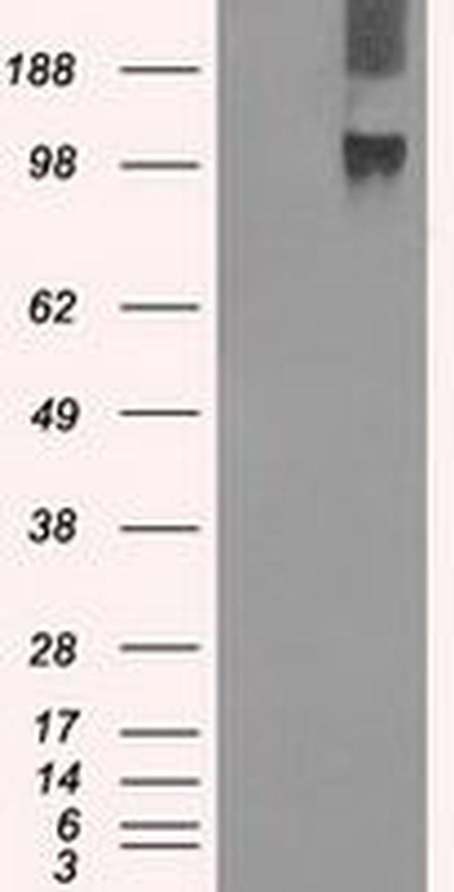 BUB1B Antibody in Western Blot (WB)