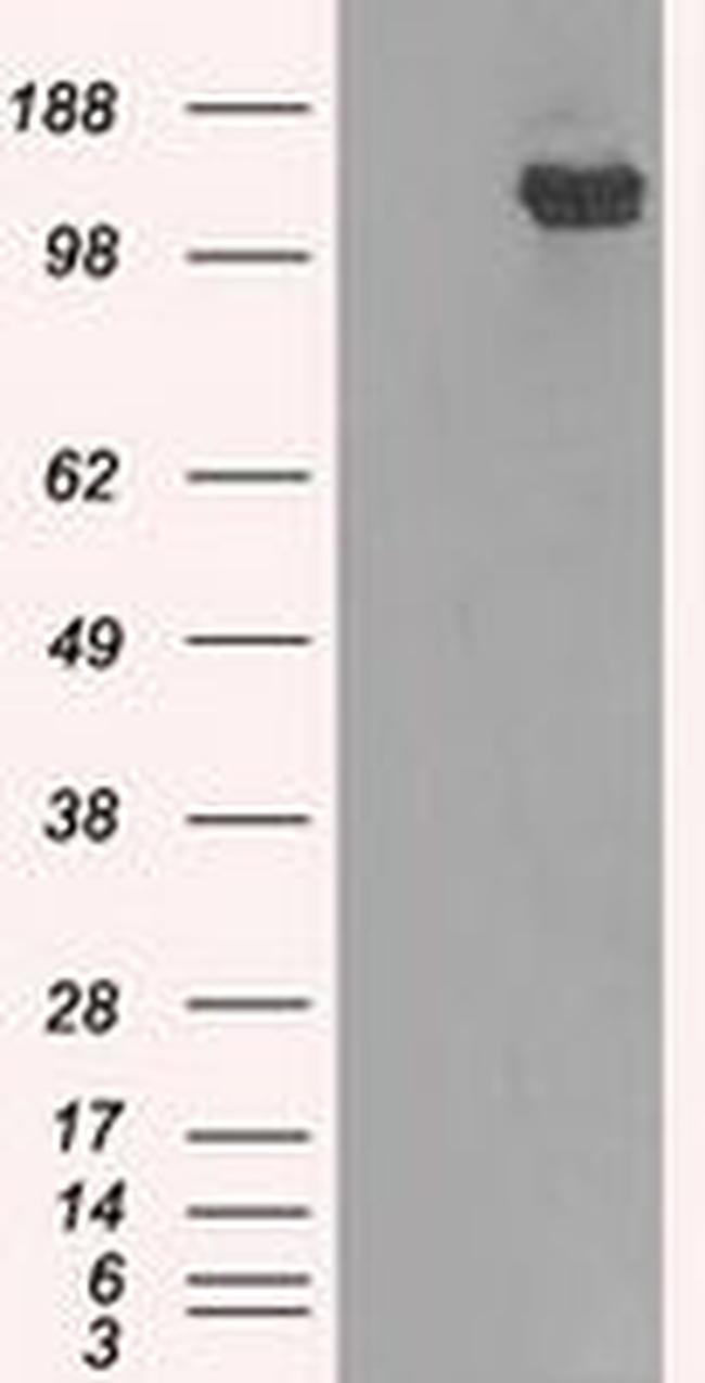 BUB1B Antibody in Western Blot (WB)