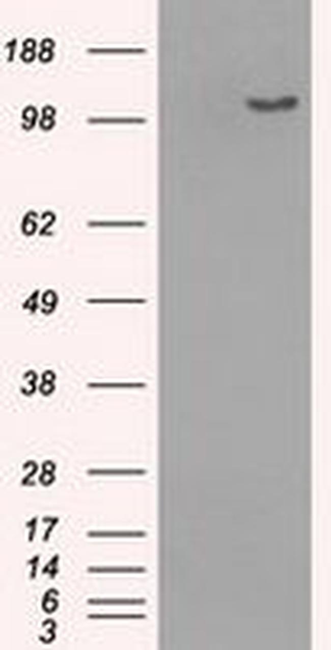 BUB1B Antibody in Western Blot (WB)