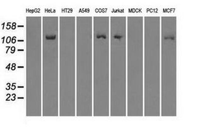 BUB1B Antibody in Western Blot (WB)