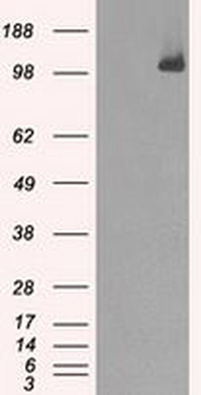 BUB1B Antibody in Western Blot (WB)