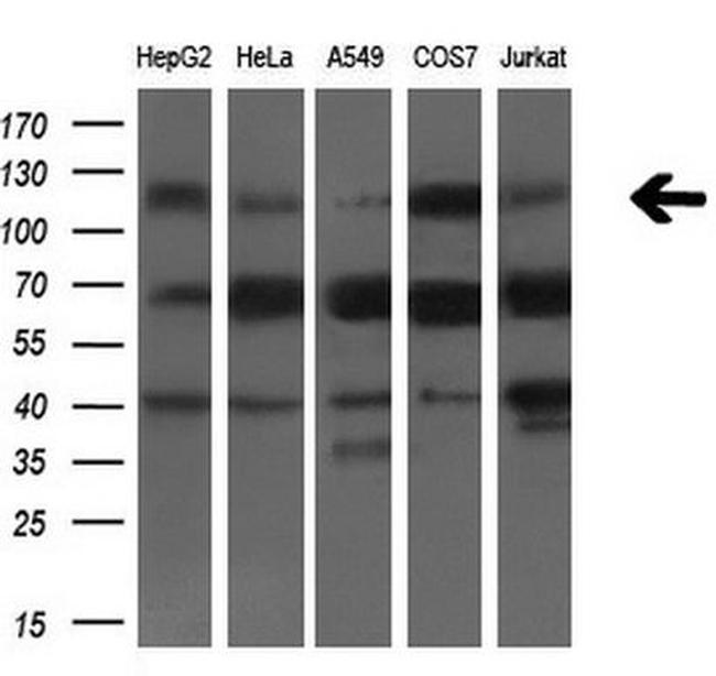 BUB1B Antibody in Western Blot (WB)