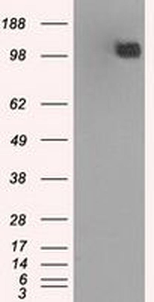 BUB1B Antibody in Western Blot (WB)