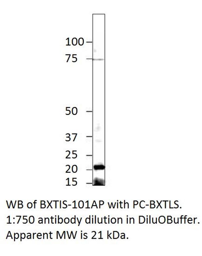 Beta crystallin S Antibody in Western Blot (WB)