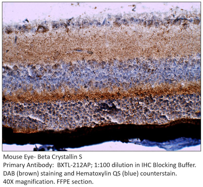 Beta crystallin S Antibody in Immunohistochemistry (IHC)