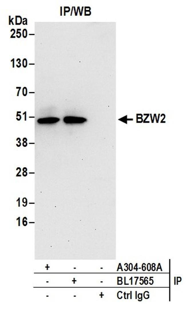 BZW2 Antibody in Western Blot (WB)