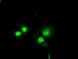 Bcl-XL Antibody in Immunocytochemistry (ICC/IF)