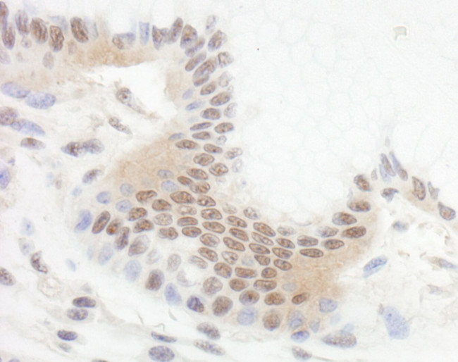 Bcl11b Antibody in Immunohistochemistry (IHC)