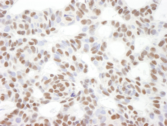 Bcl11b Antibody in Immunohistochemistry (IHC)