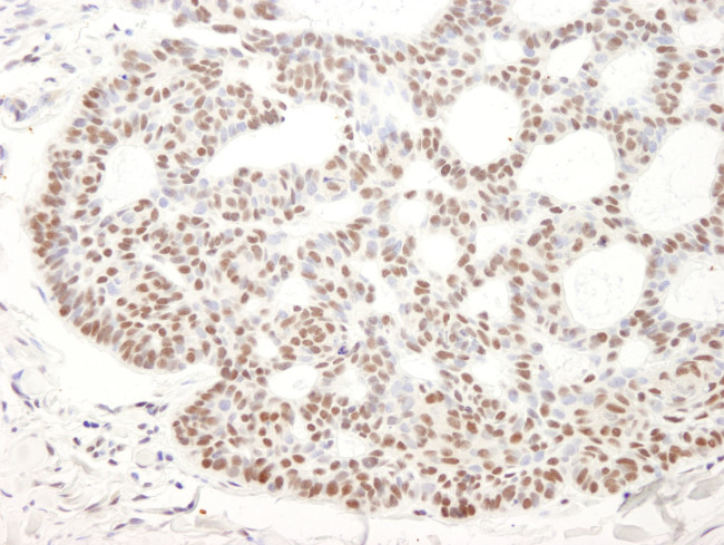 Bcl11b Antibody in Immunohistochemistry (IHC)