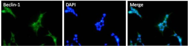 Beclin 1 Antibody in Immunocytochemistry (ICC/IF)