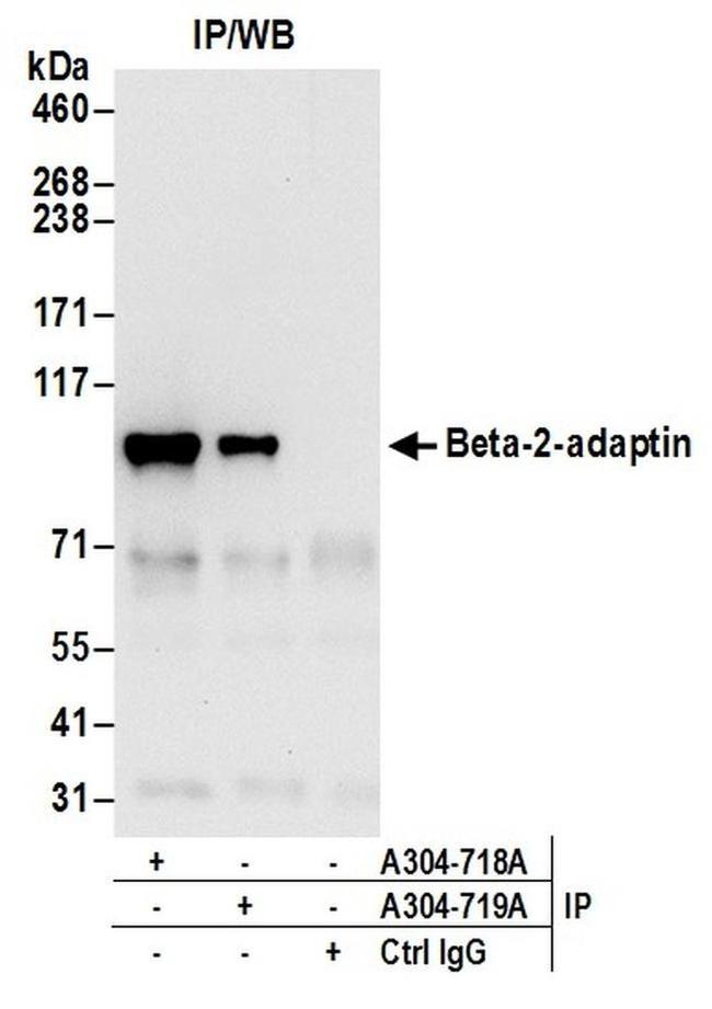 Beta-2-adaptin Antibody in Western Blot (WB)