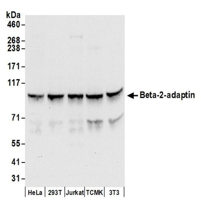 Beta-2-adaptin Antibody in Western Blot (WB)