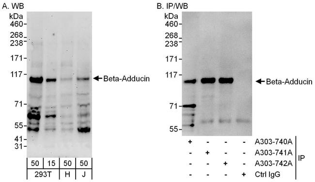 Beta-Adducin Antibody in Western Blot (WB)