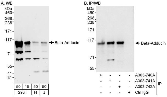 Beta-Adducin Antibody in Western Blot (WB)