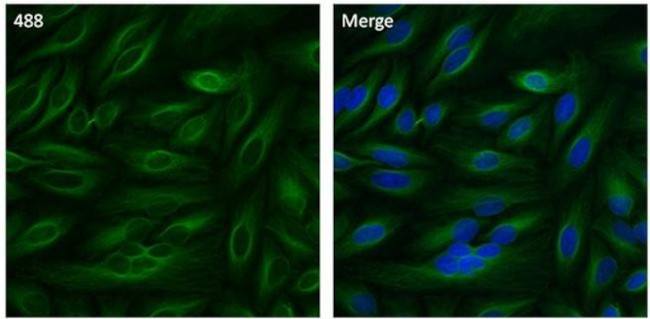 beta Tubulin Antibody in Immunocytochemistry (ICC/IF)