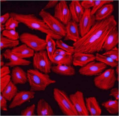 beta Actin Loading Control Antibody in Immunocytochemistry (ICC/IF)