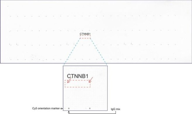 Beta-catenin Antibody in Peptide array (ARRAY)