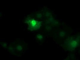 Beta-catenin Antibody in Immunocytochemistry (ICC/IF)