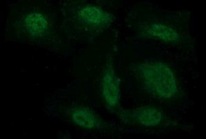 Beta-catenin Antibody in Immunocytochemistry (ICC/IF)