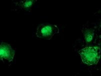 Beta-catenin Antibody in Immunocytochemistry (ICC/IF)