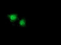 Beta-catenin Antibody in Immunocytochemistry (ICC/IF)