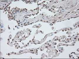 Beta-catenin Antibody in Immunohistochemistry (Paraffin) (IHC (P))