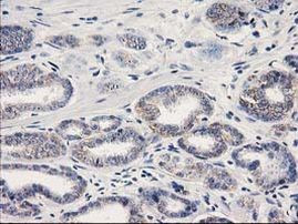 Beta-catenin Antibody in Immunohistochemistry (Paraffin) (IHC (P))