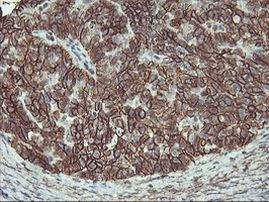 Beta-catenin Antibody in Immunohistochemistry (Paraffin) (IHC (P))