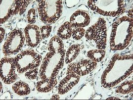 Beta-catenin Antibody in Immunohistochemistry (Paraffin) (IHC (P))