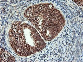 Beta-catenin Antibody in Immunohistochemistry (Paraffin) (IHC (P))