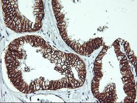 Beta-catenin Antibody in Immunohistochemistry (Paraffin) (IHC (P))