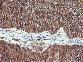 Beta-catenin Antibody in Immunohistochemistry (Paraffin) (IHC (P))