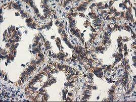 Beta-catenin Antibody in Immunohistochemistry (Paraffin) (IHC (P))