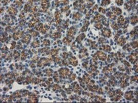 Beta-catenin Antibody in Immunohistochemistry (Paraffin) (IHC (P))