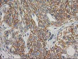 Beta-catenin Antibody in Immunohistochemistry (Paraffin) (IHC (P))