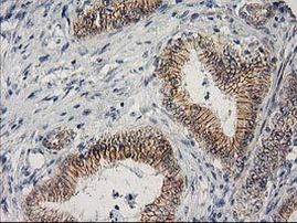 Beta-catenin Antibody in Immunohistochemistry (Paraffin) (IHC (P))