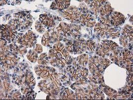 Beta-catenin Antibody in Immunohistochemistry (Paraffin) (IHC (P))