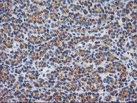 Beta-catenin Antibody in Immunohistochemistry (Paraffin) (IHC (P))