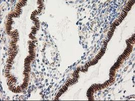 Beta-catenin Antibody in Immunohistochemistry (Paraffin) (IHC (P))