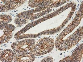 Beta-catenin Antibody in Immunohistochemistry (Paraffin) (IHC (P))