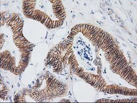 Beta-catenin Antibody in Immunohistochemistry (Paraffin) (IHC (P))